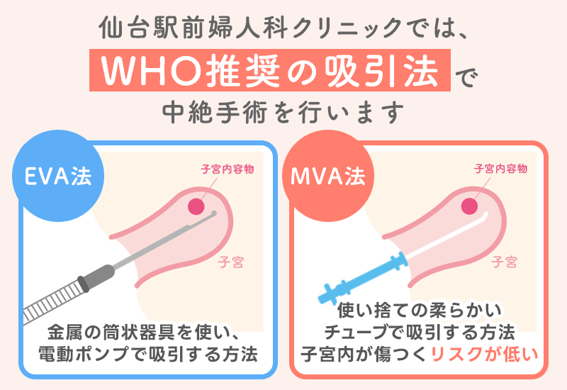 仙台駅前婦人科クリニックではWHO推奨の吸引法で中絶手術を行います