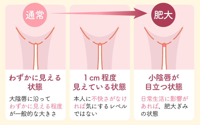 小陰唇（ビラビラ）の平均の大きさは？