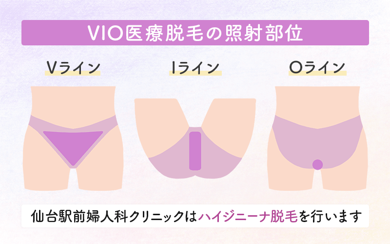 VIO医療脱毛の照射部位