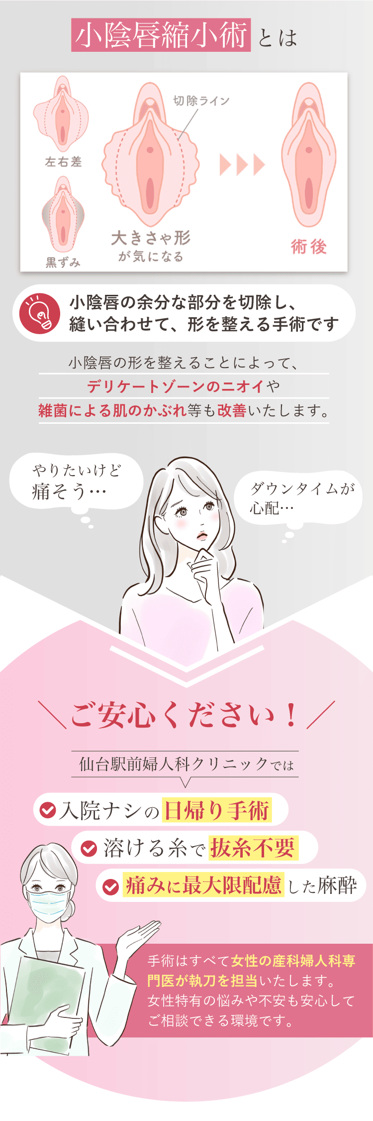 小陰唇縮小術とは