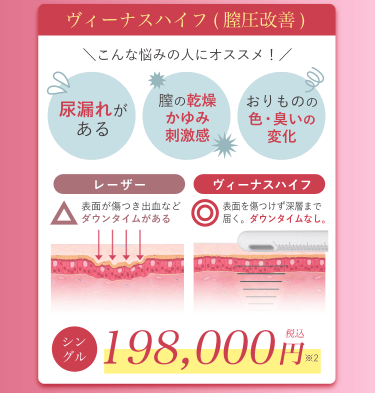 ヴィーナスハイフ(膣圧改善)の料金