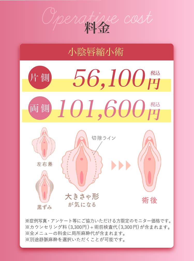 婦人科形成の費用